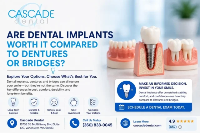 Are Dental Implants WOrth It