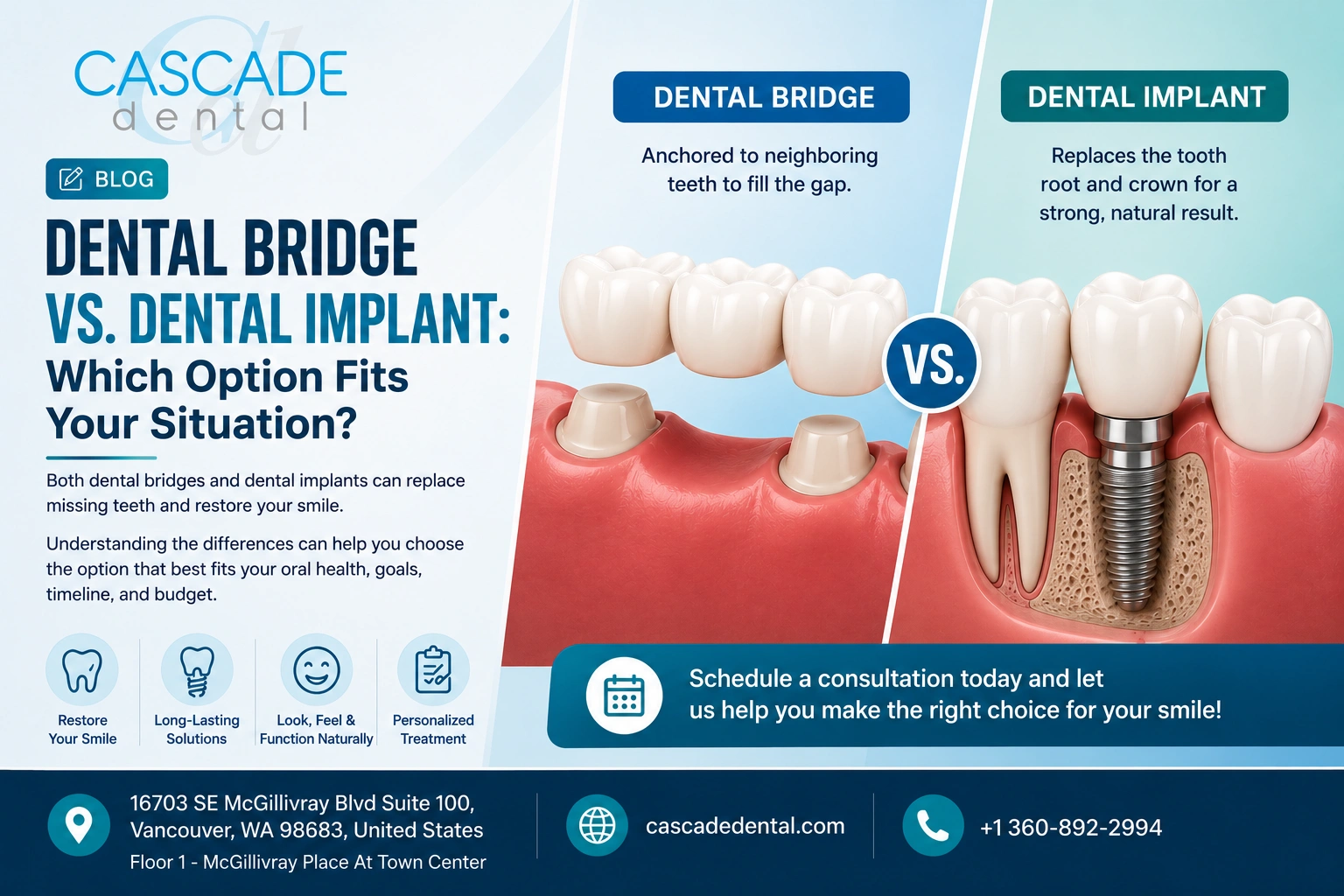 Dental Implants Vs. Bridges