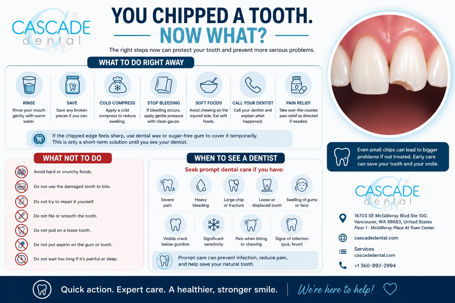 Cascade Dental Chipped Tooth Infographic 2 You Chipped Tooth Now What?