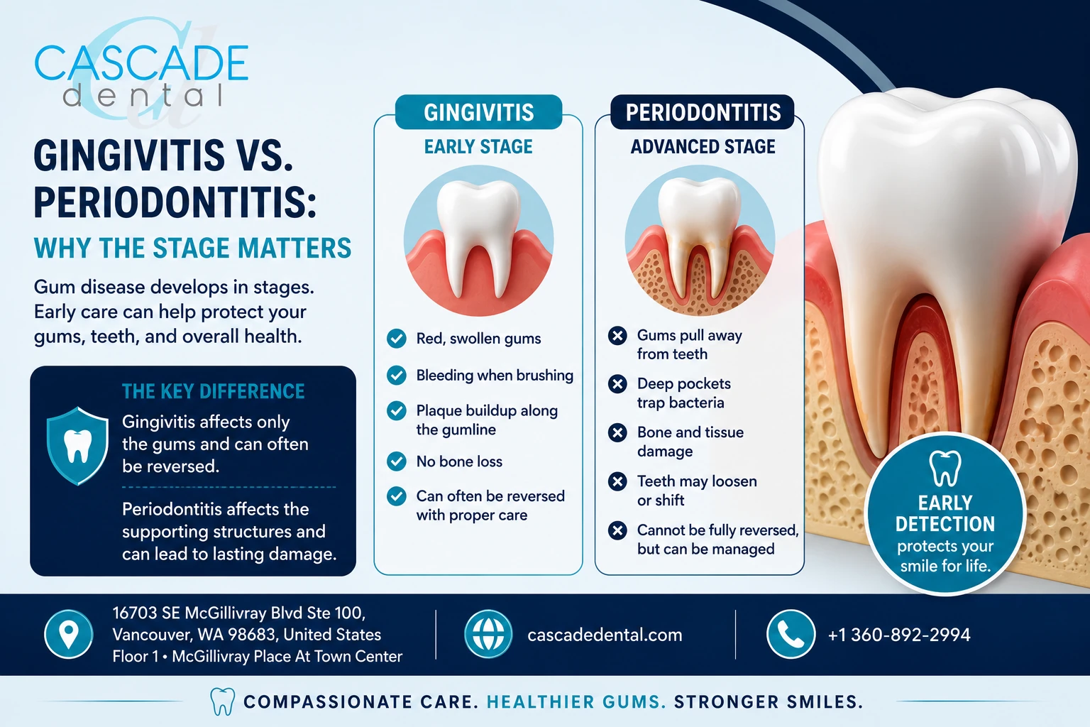 Gingivitis Vs. Periodontitis