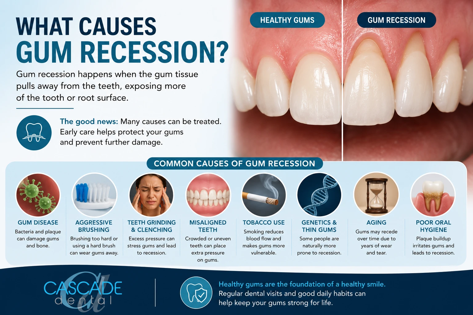 What Causes Gum Recession