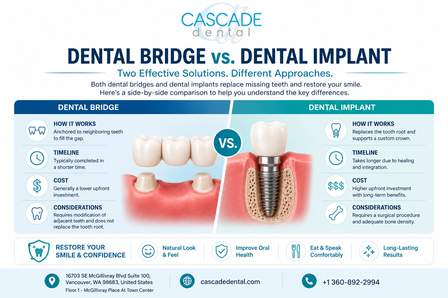 Dental Bridge Vs. Dental Implants