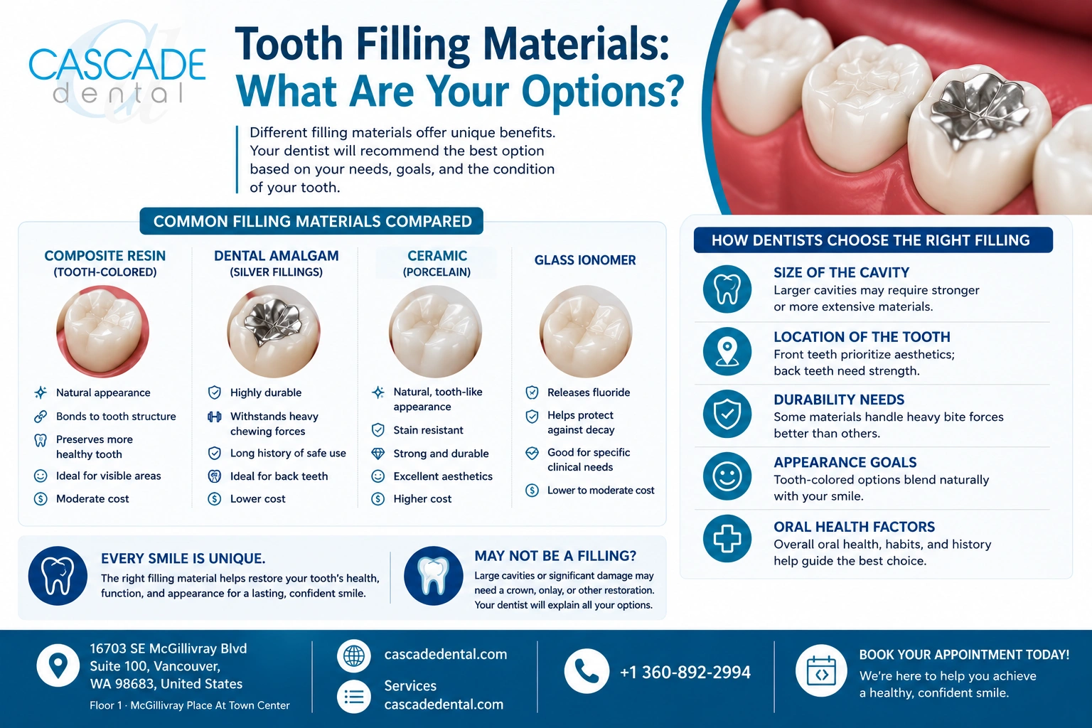 Cascade Dental Tooth Filling Materials Mid Content Infographic 2 Tooth Fillings What Are Your Options