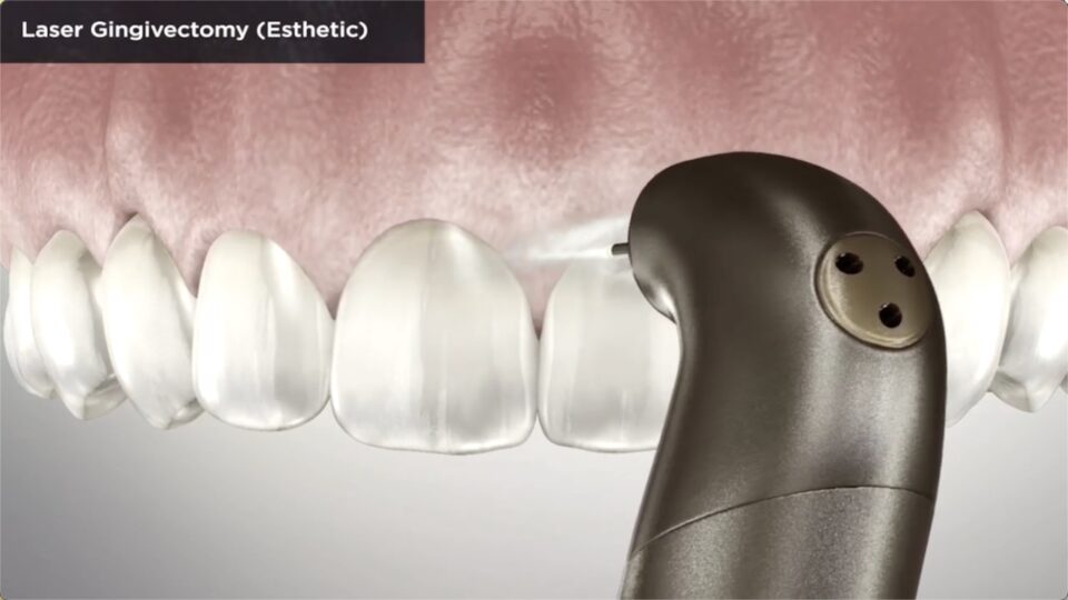Aesthetic Dentist Vancouver Wa
