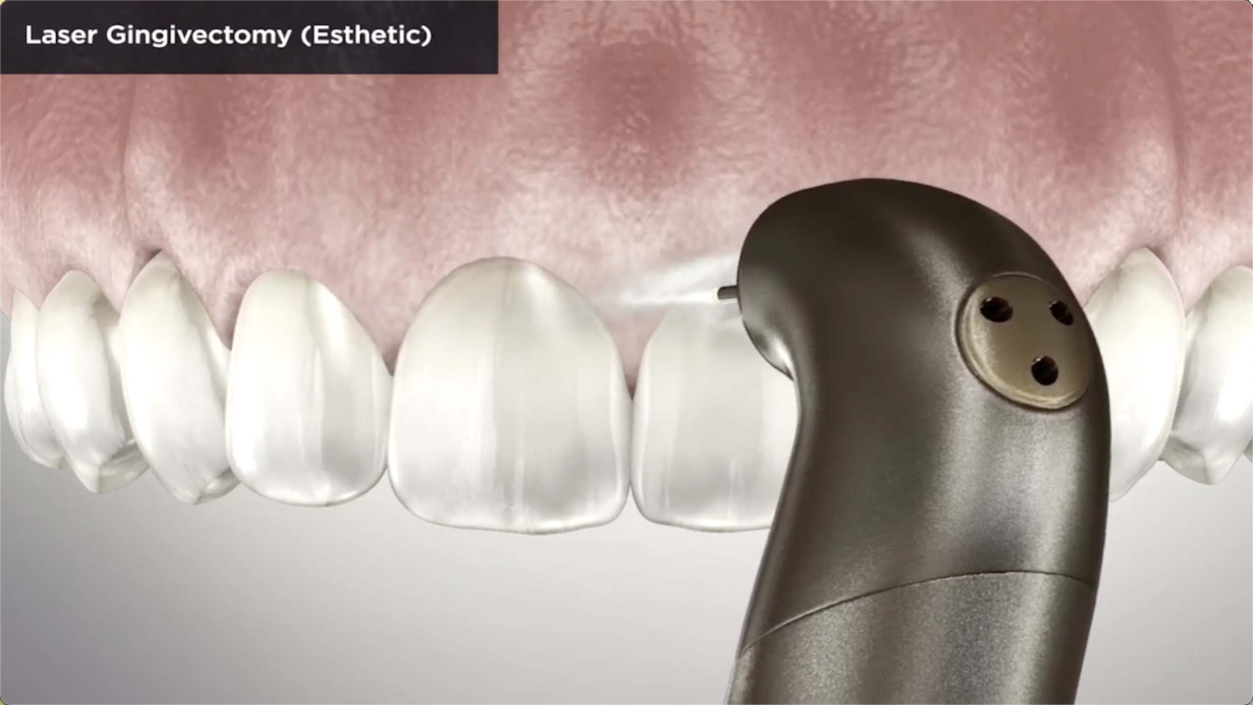 Aesthetic Dentist Vancouver WA