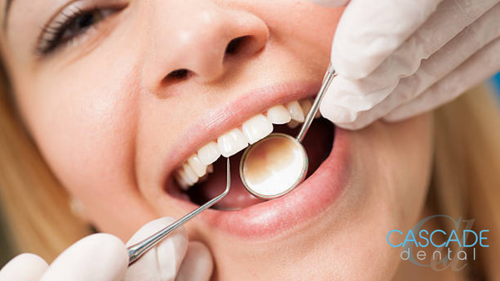 Dental Exam Vancouver WA