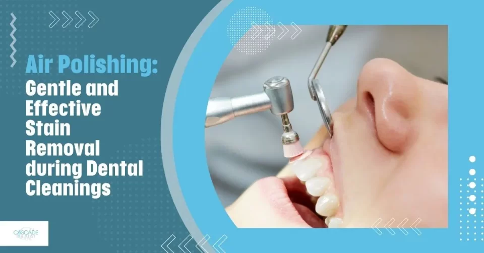 Air Polishing: Gentle and Effective Stain Removal During Dental Cleanings