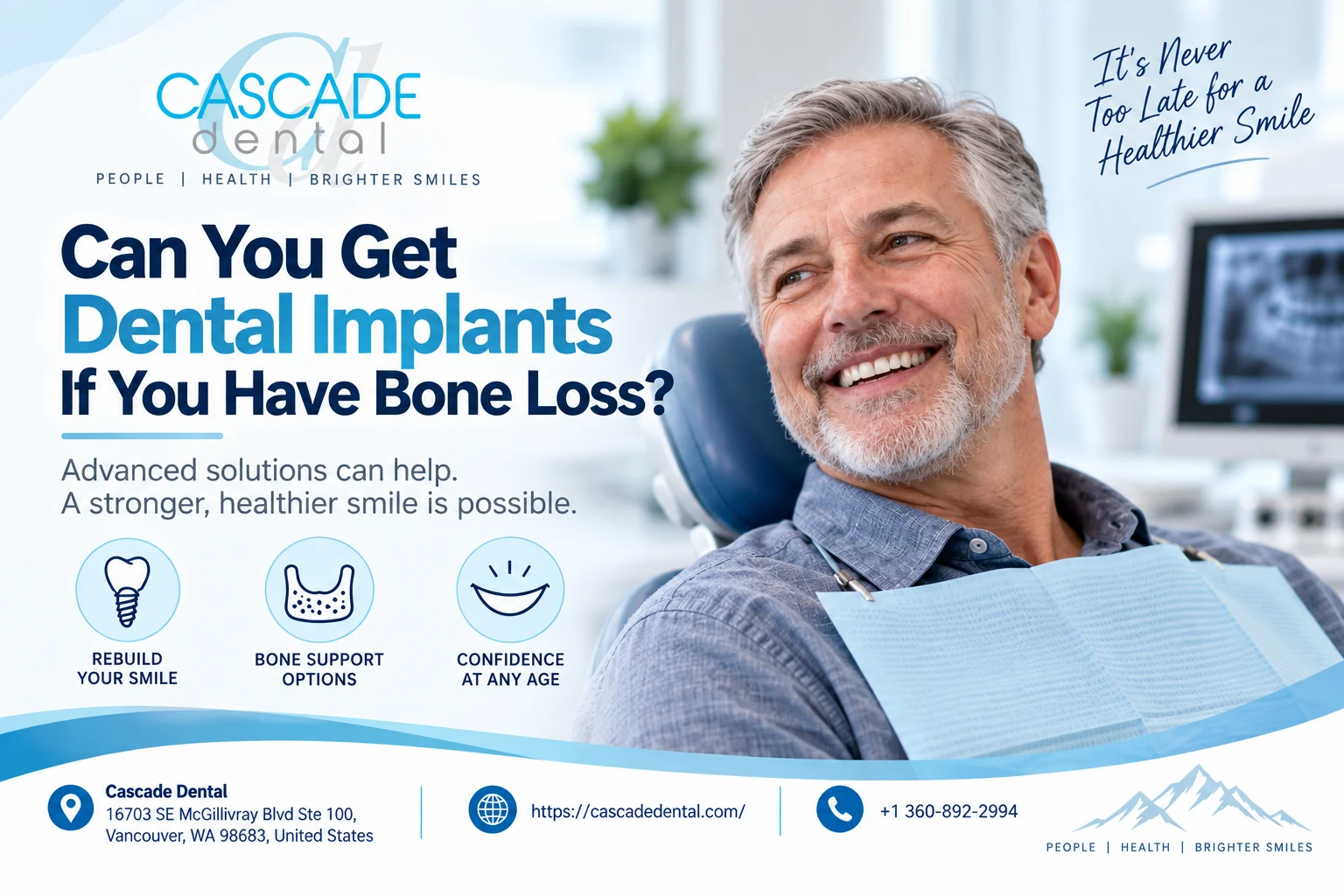 Can You Get Dental Implants If You Have Bone Loss?
