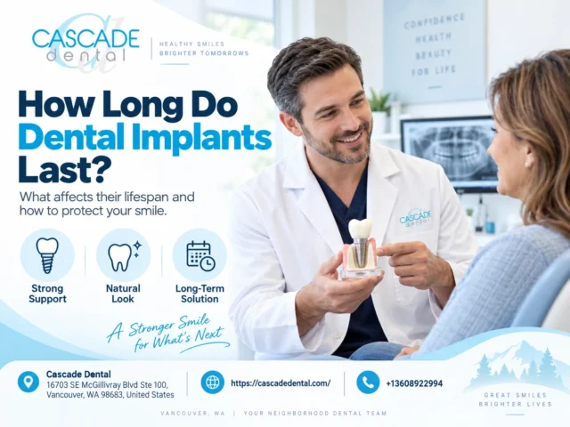 How Long Do Dental Implants Last?