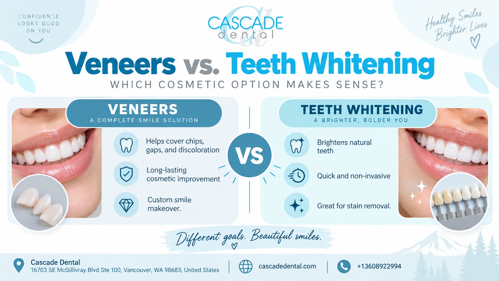 Veneers Vs. Teeth Whitening: Which Should You Choose?