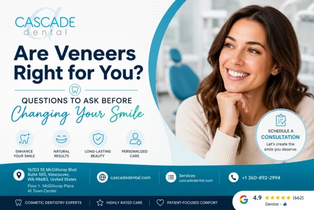 Dental Veneers