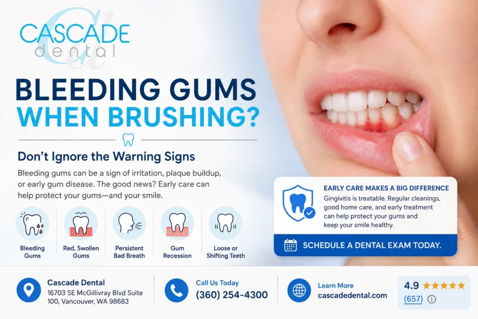 Dental Bleeding Gums