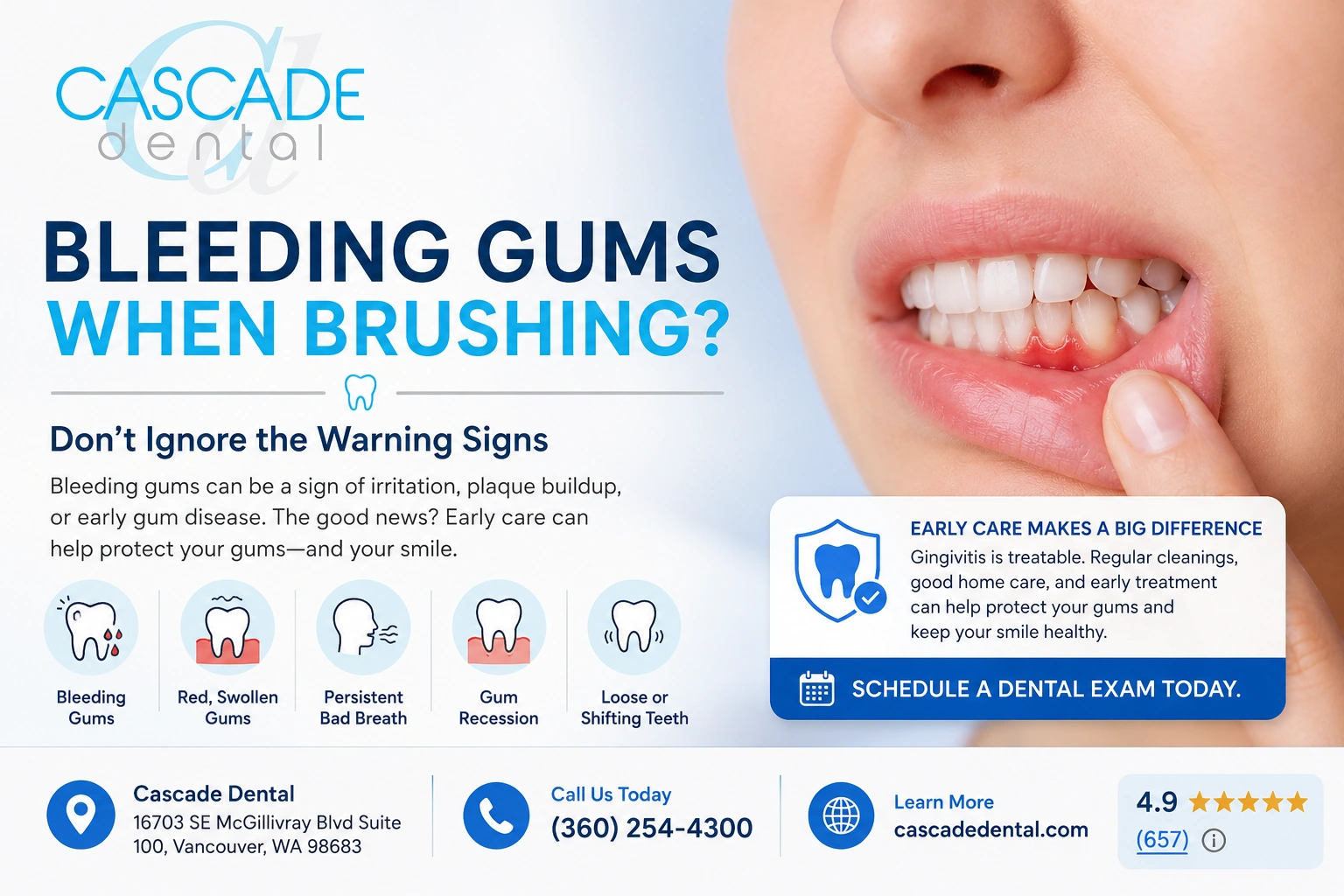 Dental Bleeding Gums