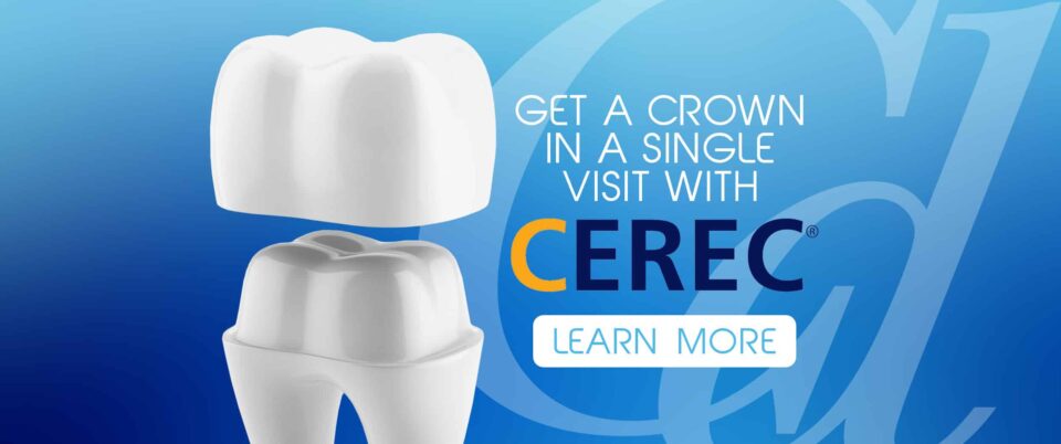 Same-Day Dental Crowns Vancouver WA