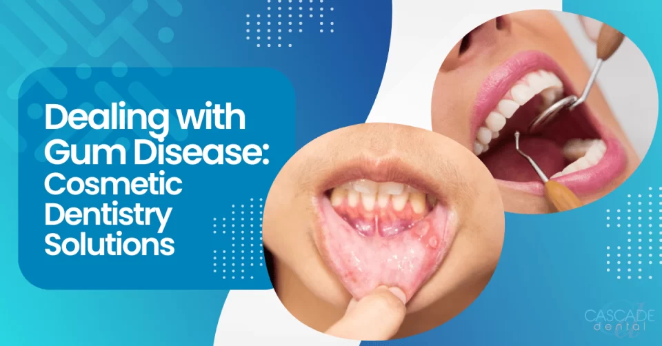 dealing with gum disease cosmetic dentistry solutions