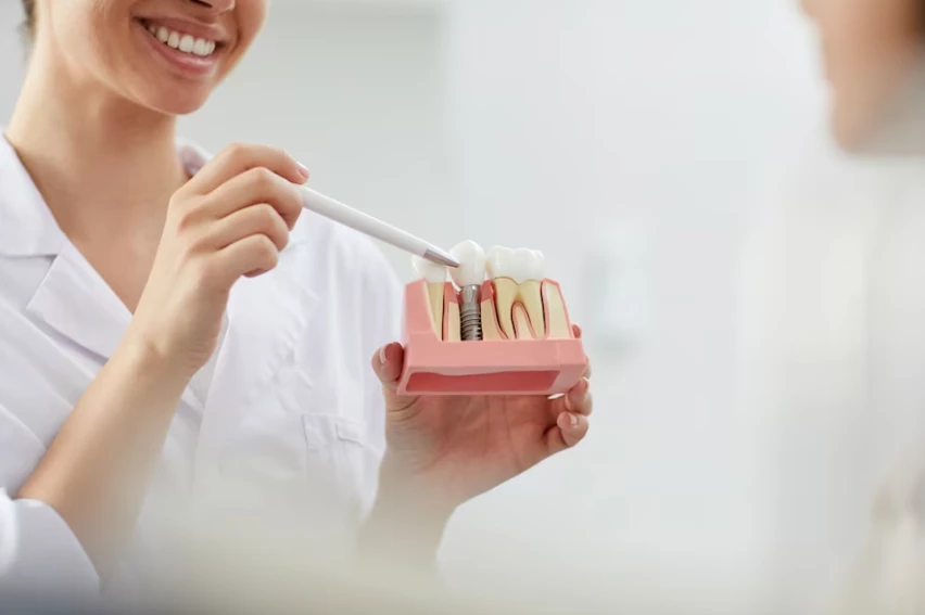dental implant material