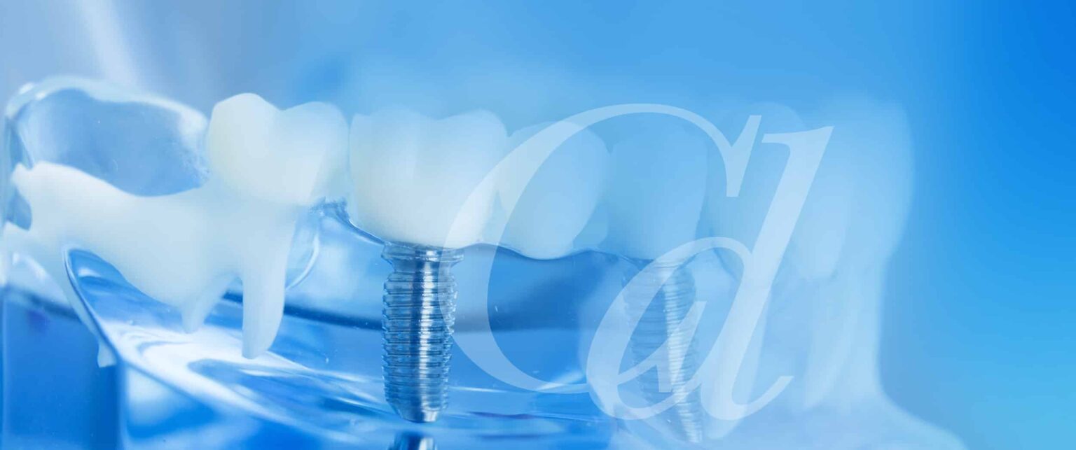 Subperiosteal Implants