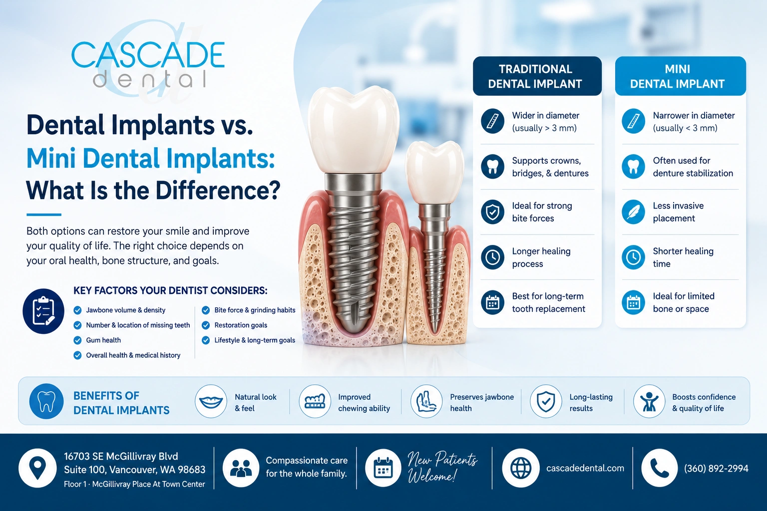 Dental Implants Vs. Mini Dental Implants