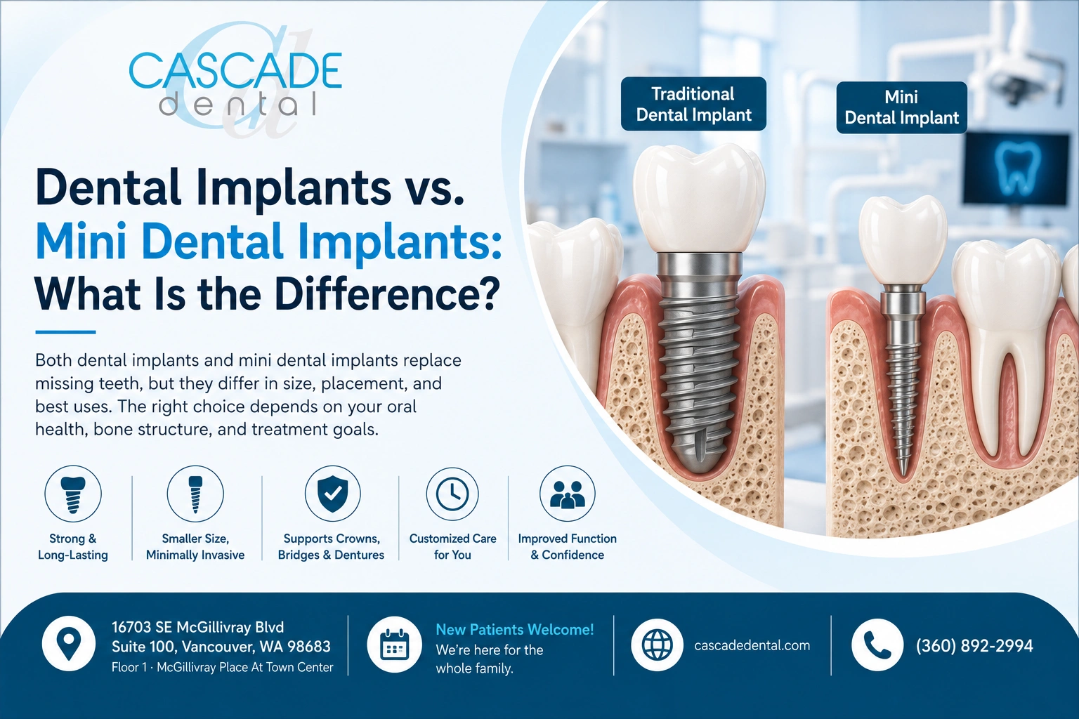 Dental Implants