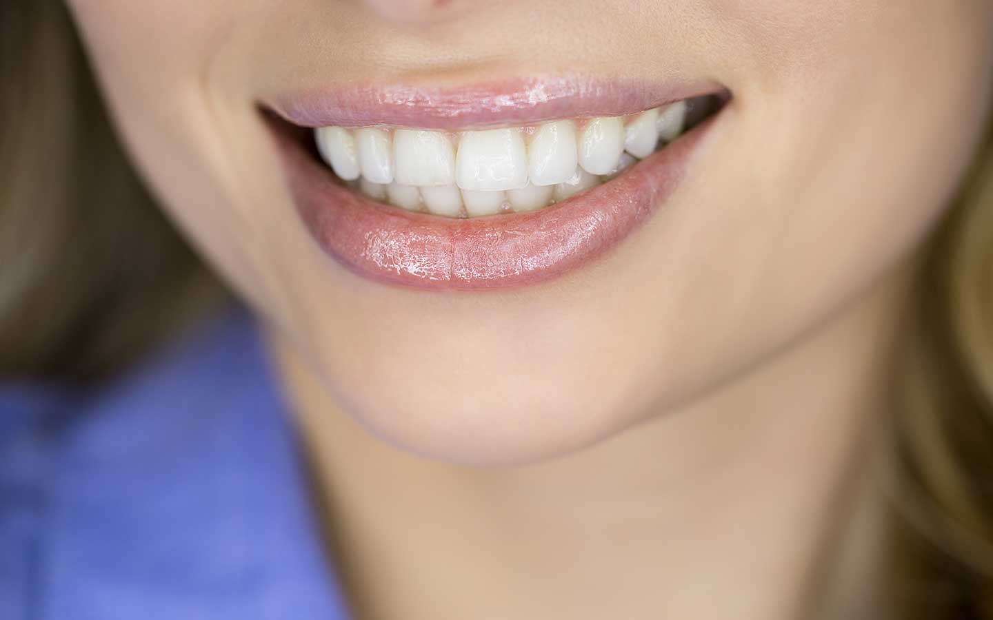 Teeth Whitening Vancouver WA