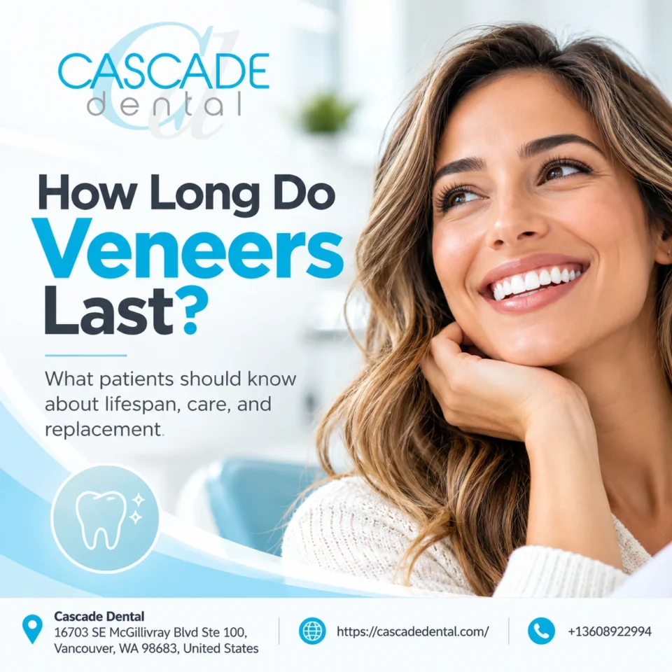 How Long Do Veneers Last