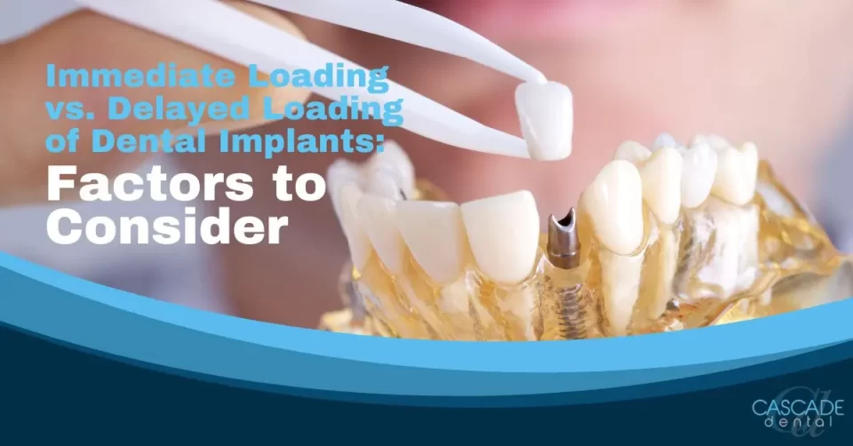 immediate loading vs. delayed loading of dental implants