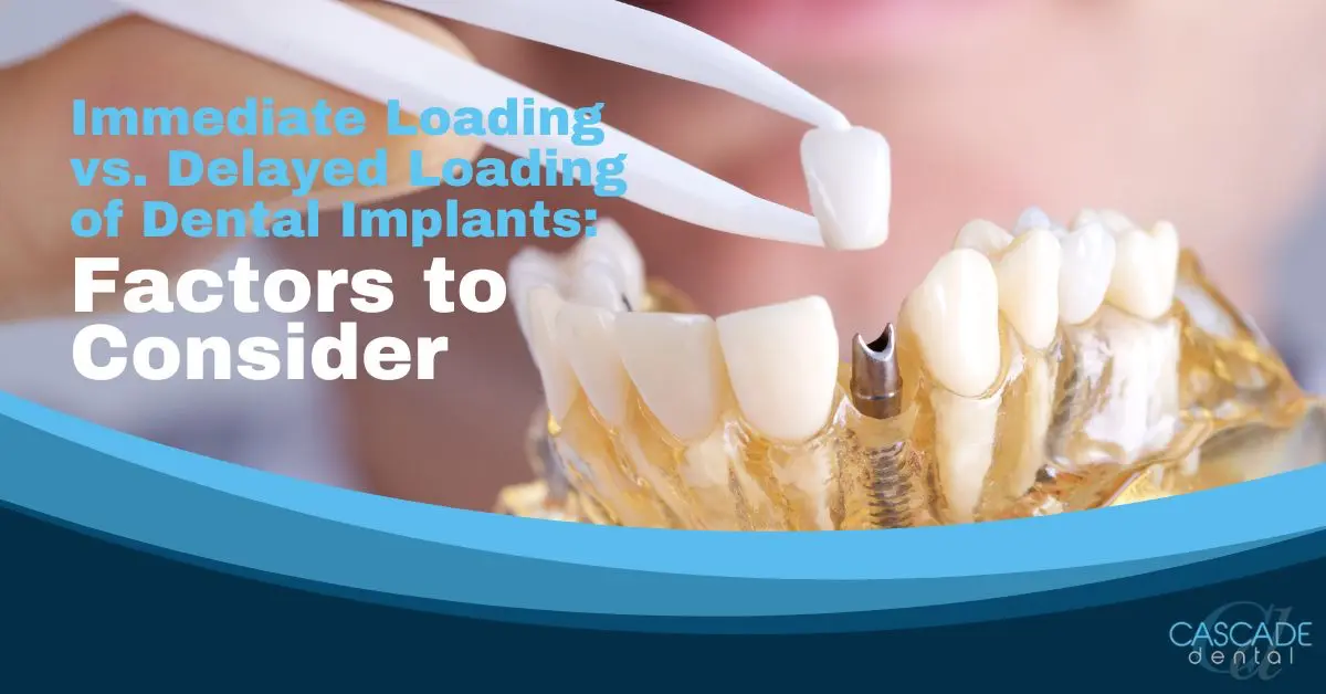 immediate loading vs. delayed loading of dental implants