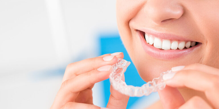 Clear Aligners Near Me