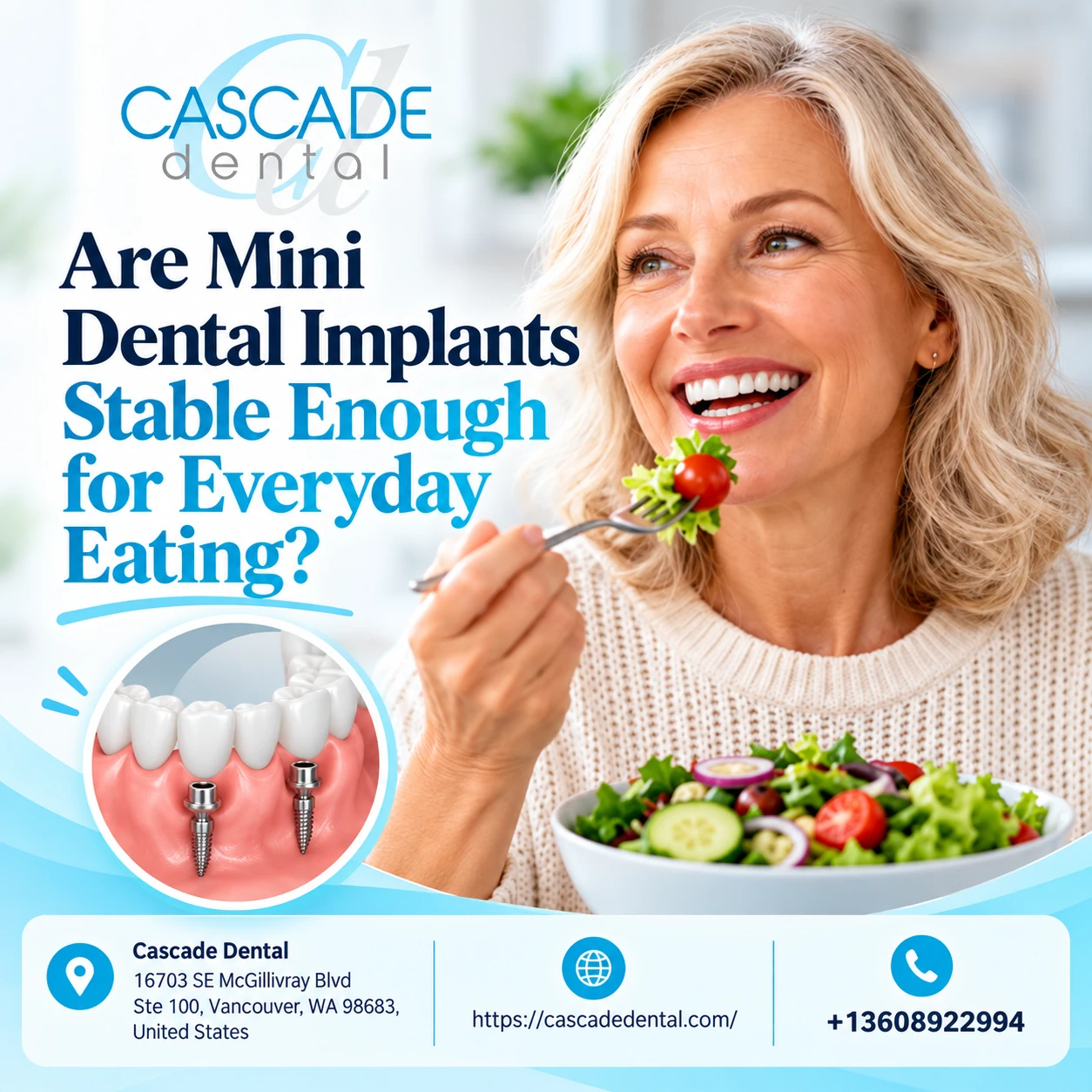 Are Mini Dental Implants Stable Enough for Everyday Eating?