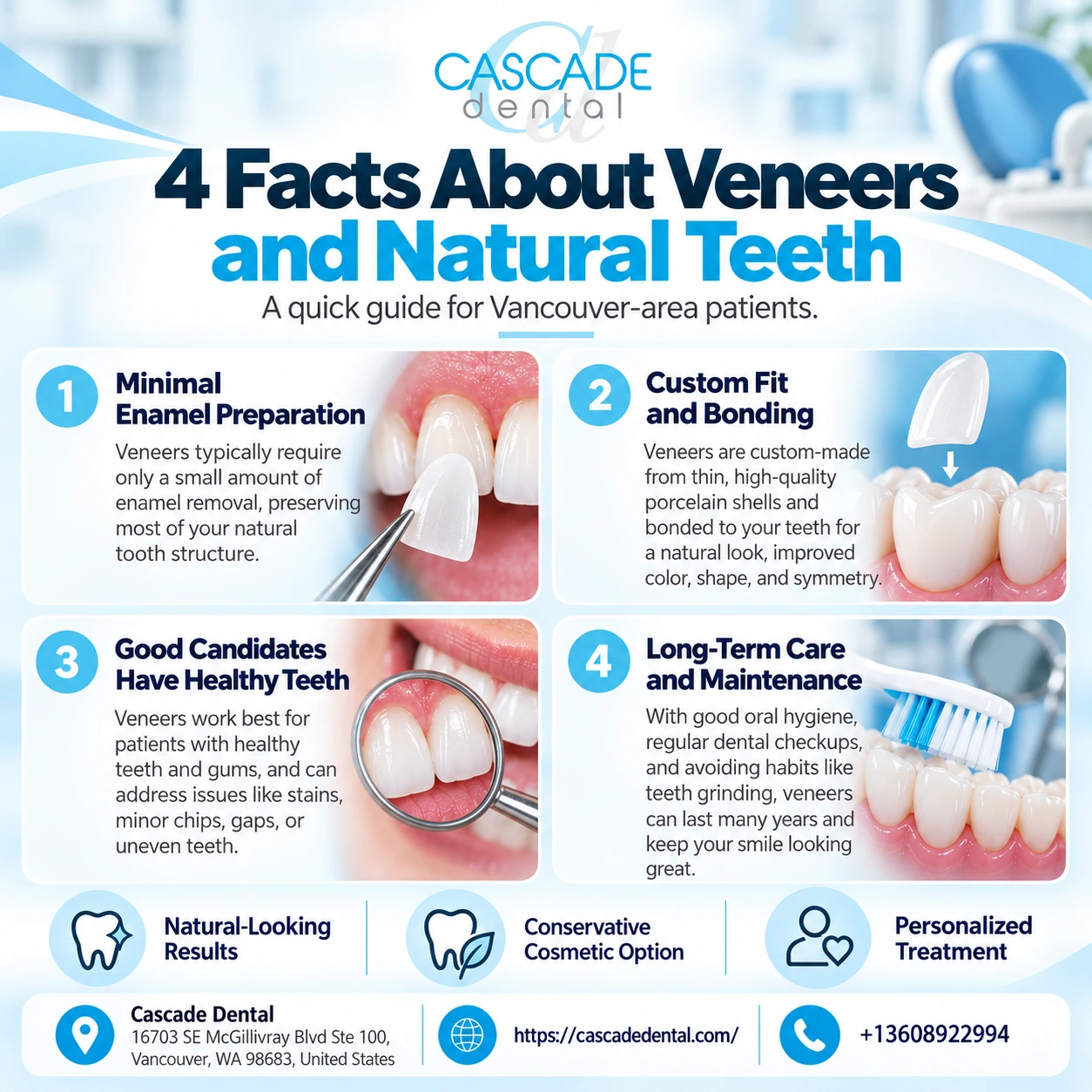 4 Facts About Veneers And Natural Teeth