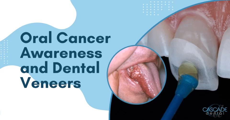 oral cancer awareness and dental veneers