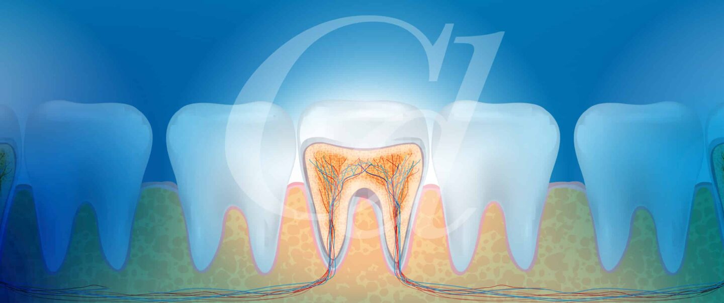 Root Canal Vancouver, WA | Tooth Abscess | Cascade Dental