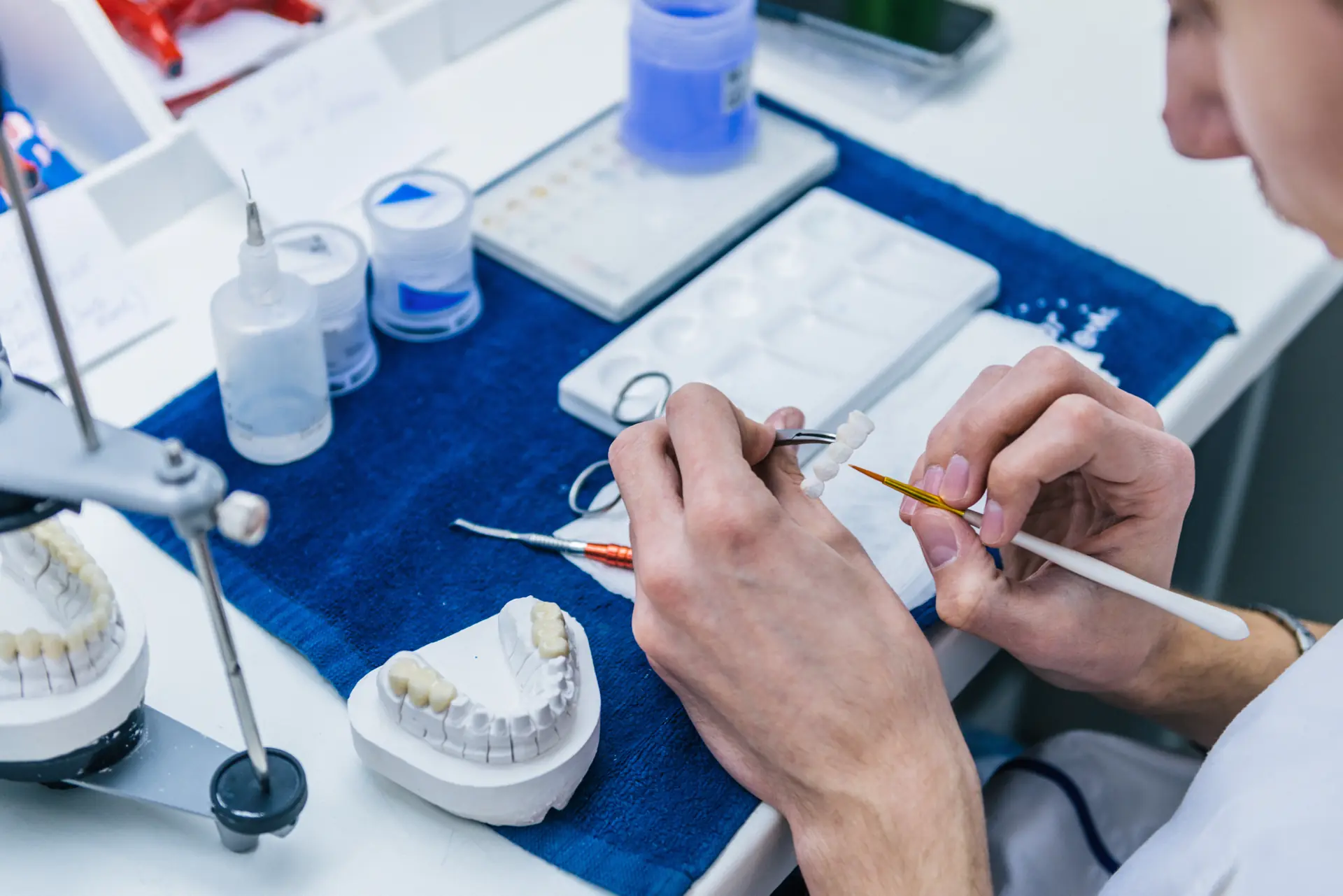 Dental Bridge dentist