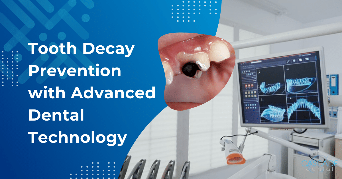 tooth decay prevention with advanced dental technology