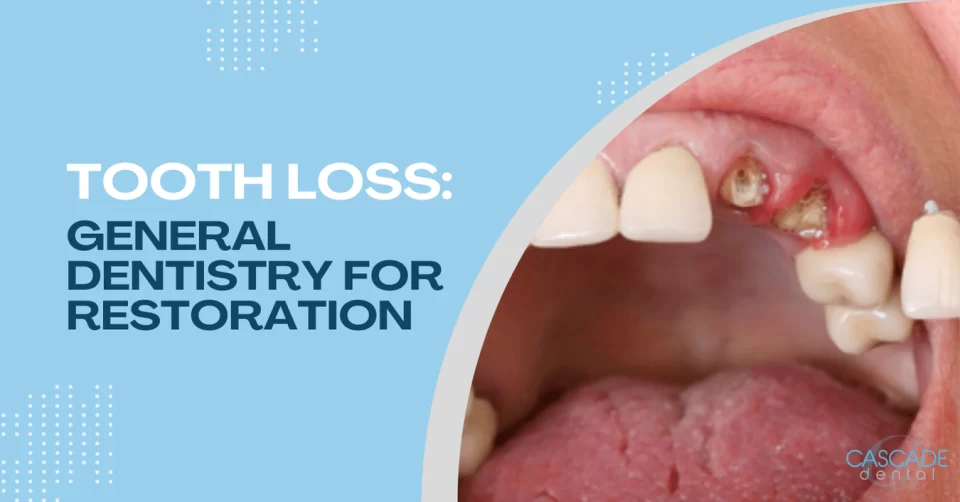 tooth loss general dentistry for restoration
