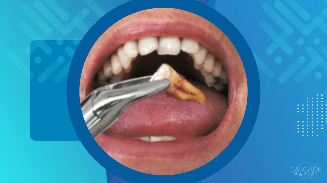 understanding the reasons behind teeth grinding and the role of tooth removal