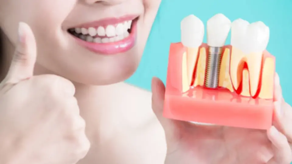 unlocking the secrets to dental implant success rediscovering smiles 1