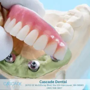 How Do Hybrid Dentures Differ From Regular Dentures