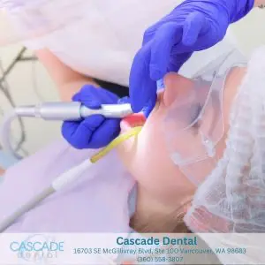 Why Cascade Dental Is Your Go-To Choice for Air Polishing