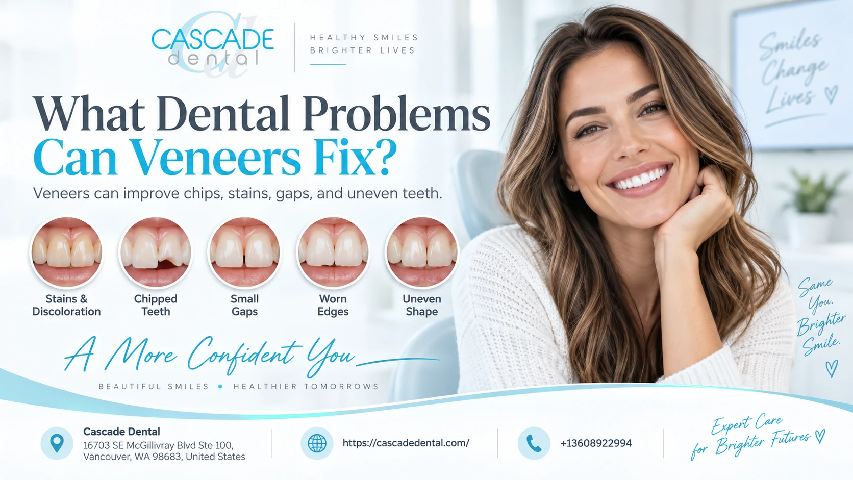 What Dental Problems Can Veneers Fix?