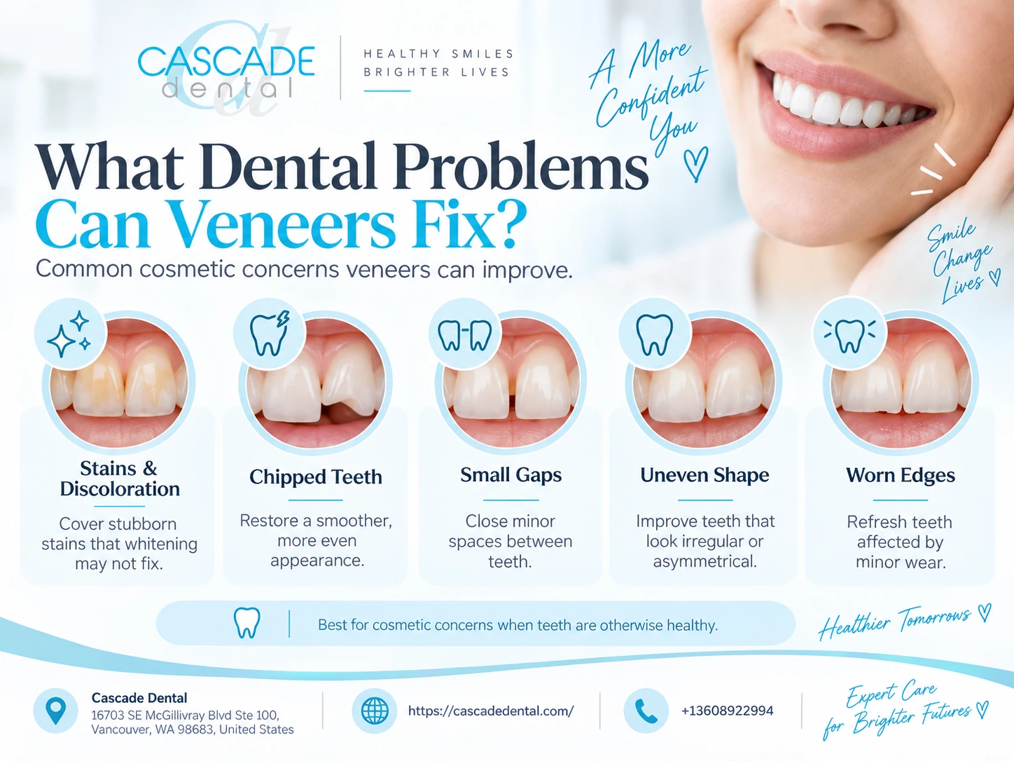 Veneers Fix Middle What Dental Problems Can Veneers Fix? 2